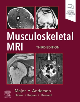 Musculoskeletal MRI 3rd Edition 2020